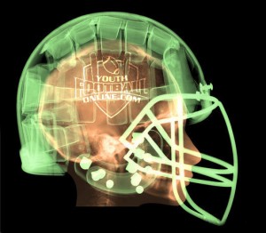 concussions in youth football 